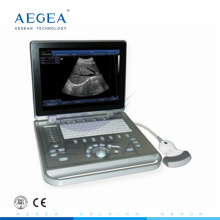 AG-BU009 tipo de portátil para escáner de ultrasonido humano o veterinario china